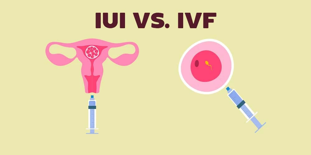 تفاوت بین IVF و IUI 