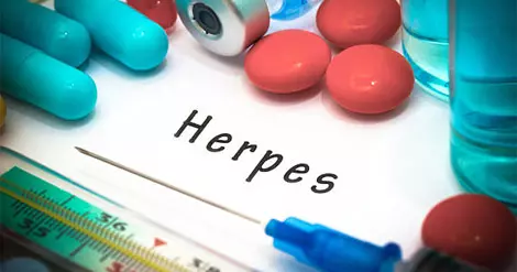هرپس یا تبخال تناسلی چگونه درمان می‌شود؟